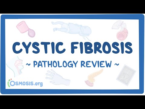 What Kind of Medical Assistance is Needed for Cystic Fibrosis?