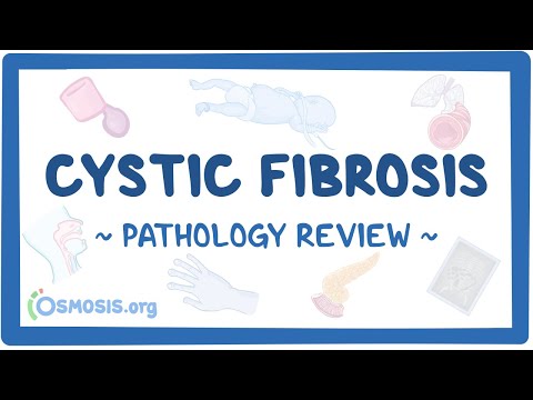 What Medical Assistance is Needed for Cystic Fibrosis?