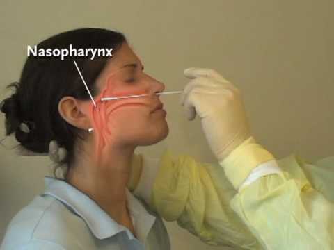 Can Medical Assistants Do Nasopharyngeal Swabs?